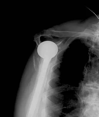 General Orthopedics 2026 Practice Questions: Set 1 (Solved) - Figure 51