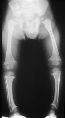 General Orthopedics 2026 Practice Questions: Set 1 (Solved) - Figure 52