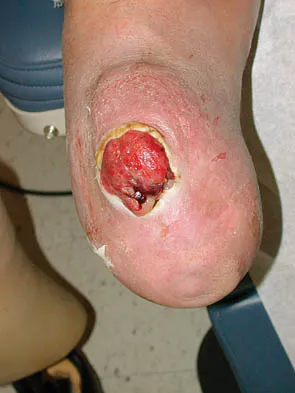 General Orthopedics 2026 Practice Questions: Set 1 (Solved) - Figure 53