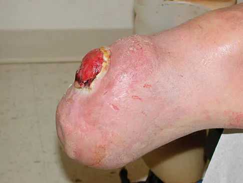 General Orthopedics 2026 Practice Questions: Set 1 (Solved) - Figure 54