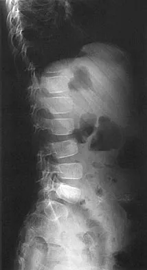 General Orthopedics 2026 Practice Questions: Set 1 (Solved) - Figure 6