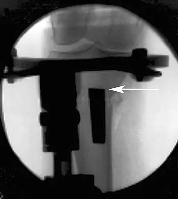 General Orthopedics 2026 Practice Questions: Set 1 (Solved) - Figure 67