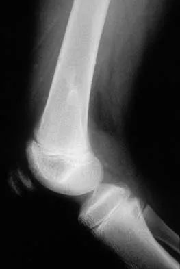 General Orthopedics 2026 Practice Questions: Set 1 (Solved) - Figure 69