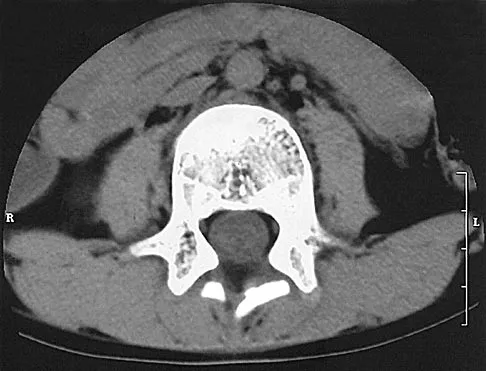 General Orthopedics 2026 Practice Questions: Set 1 (Solved) - Figure 7
