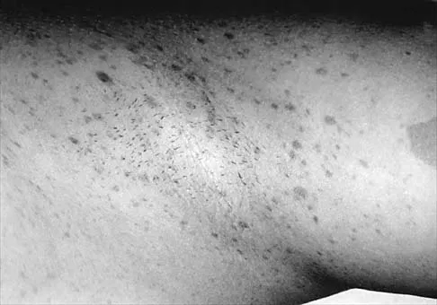 General Orthopedics 2026 Practice Questions: Set 1 (Solved) - Figure 74