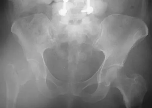 General Orthopedics 2026 Practice Questions: Set 1 (Solved) - Figure 75