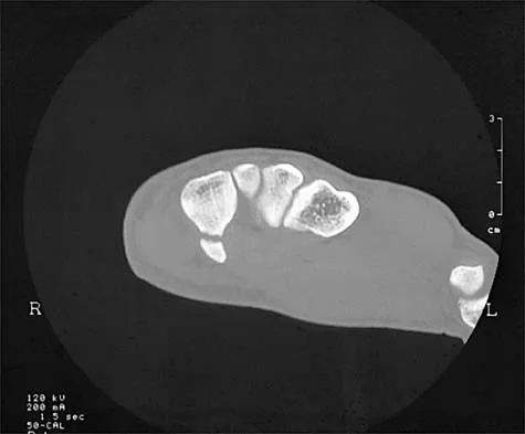 General Orthopedics 2026 Practice Questions: Set 1 (Solved) - Figure 76
