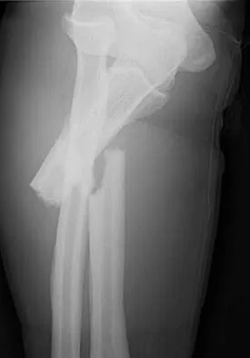 General Orthopedics 2026 Practice Questions: Set 1 (Solved) - Figure 77