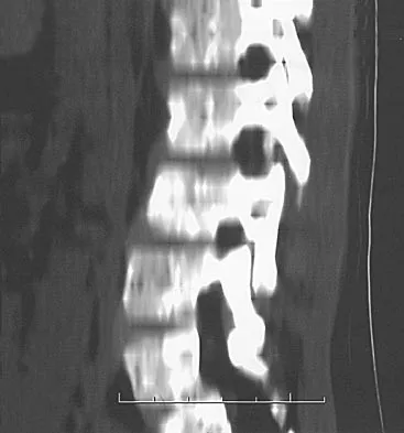 General Orthopedics 2026 Practice Questions: Set 1 (Solved) - Figure 8