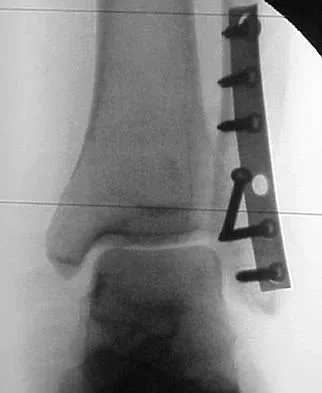 General Orthopedics 2026 Practice Questions: Set 1 (Solved) - Figure 81