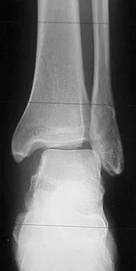 General Orthopedics 2026 Practice Questions: Set 1 (Solved) - Figure 82