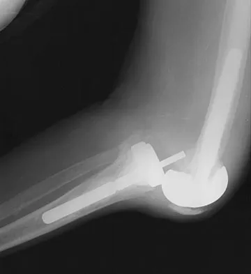 General Orthopedics 2026 Practice Questions: Set 1 (Solved) - Figure 83
