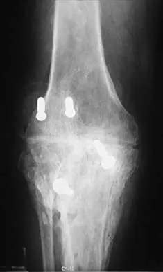 General Orthopedics 2026 Practice Questions: Set 1 (Solved) - Figure 88