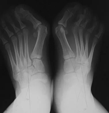 General Orthopedics 2026 Practice Questions: Set 1 (Solved) - Figure 89
