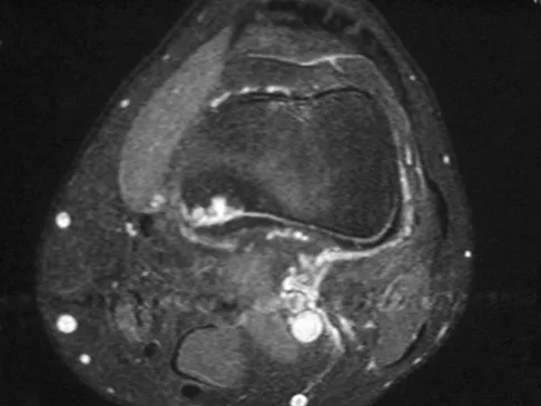 General Orthopedics Board Review 2026: High-Yield MCQs (Set 10) - Figure 10