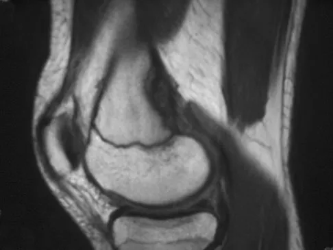 General Orthopedics Board Review 2026: High-Yield MCQs (Set 10) - Figure 12