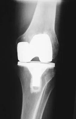 Click to enlarge General Orthopedics Board Review 2026: High-Yield MCQs (Set 10) - Figure 17