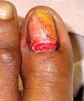 General Orthopedics Board Review 2026: High-Yield MCQs (Set 10) - Figure 18