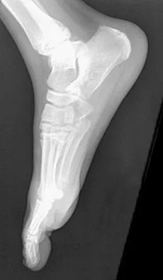 General Orthopedics Board Review 2026: High-Yield MCQs (Set 10) - Figure 19