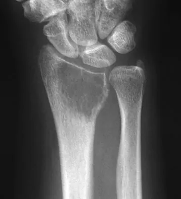 General Orthopedics Board Review 2026: High-Yield MCQs (Set 10) - Figure 25