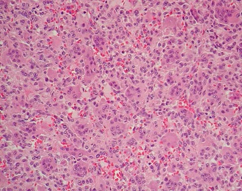 General Orthopedics Board Review 2026: High-Yield MCQs (Set 10) - Figure 28