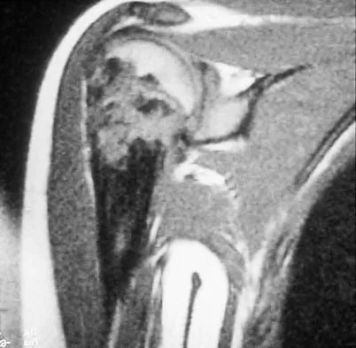 General Orthopedics Board Review 2026: High-Yield MCQs (Set 10) - Figure 32