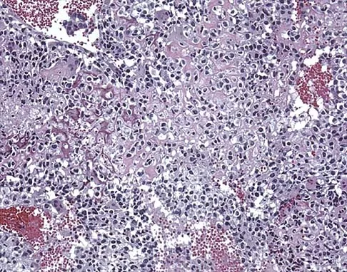 General Orthopedics Board Review 2026: High-Yield MCQs (Set 10) - Figure 33