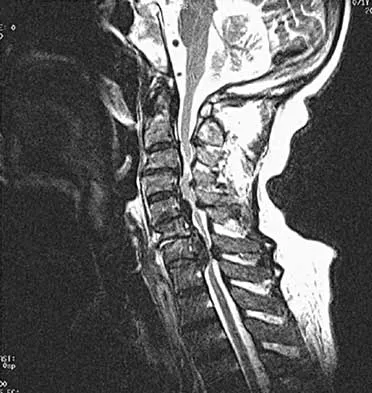 General Orthopedics Board Review 2026: High-Yield MCQs (Set 10) - Figure 35