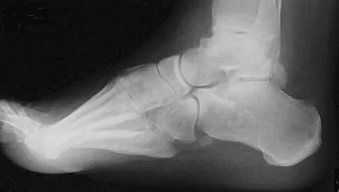 General Orthopedics Board Review 2026: High-Yield MCQs (Set 10) - Figure 36