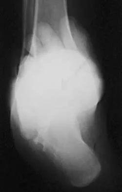 General Orthopedics Board Review 2026: High-Yield MCQs (Set 10) - Figure 38