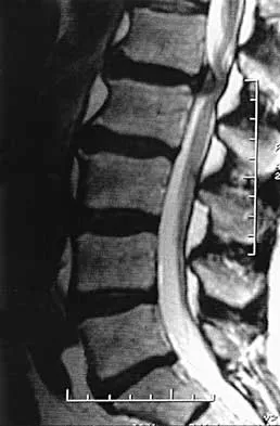 General Orthopedics Board Review 2026: High-Yield MCQs (Set 10) - Figure 42