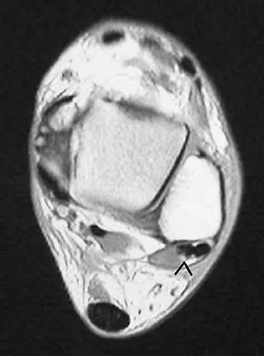General Orthopedics Board Review 2026: High-Yield MCQs (Set 10) - Figure 47