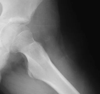 General Orthopedics Board Review 2026: High-Yield MCQs (Set 10) - Figure 48