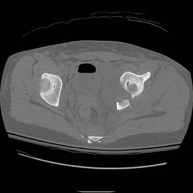 General Orthopedics Board Review 2026: High-Yield MCQs (Set 10) - Figure 5