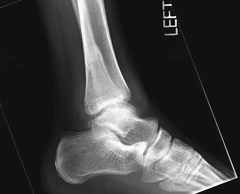 Click to enlarge General Orthopedics Board Review 2026: High-Yield MCQs (Set 10) - Figure 52