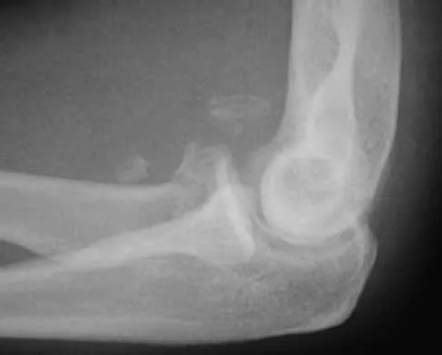 General Orthopedics Board Review 2026: High-Yield MCQs (Set 10) - Figure 57