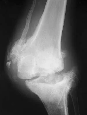 General Orthopedics Board Review 2026: High-Yield MCQs (Set 10) - Figure 7