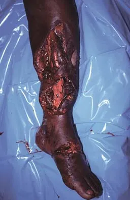 General Orthopedics Board Review 2026: High-Yield MCQs (Set 10) - Figure 72