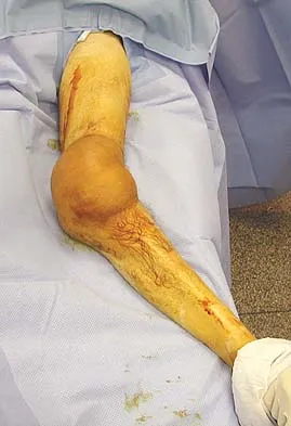 General Orthopedics Board Review 2026: High-Yield MCQs (Set 10) - Figure 8