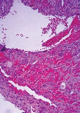General Orthopedics Board Review 2026: High-Yield MCQs (Set 10) - Figure 80