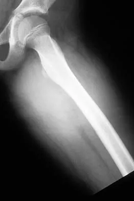 General Orthopedics Board Review 2026: High-Yield MCQs (Set 10) - Figure 81