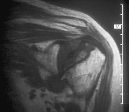 General Orthopedics Board Review 2026: High-Yield MCQs (Set 10) - Figure 85