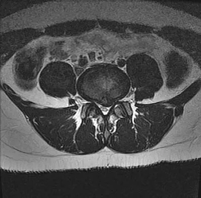 General Orthopedics Board Review 2026: High-Yield MCQs (Set 10) - Figure 89