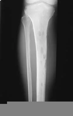 General Orthopedics 2026 Practice Questions: Set 11 (Solved) - Figure 1