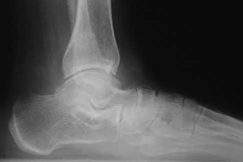 General Orthopedics 2026 Practice Questions: Set 11 (Solved) - Figure 10