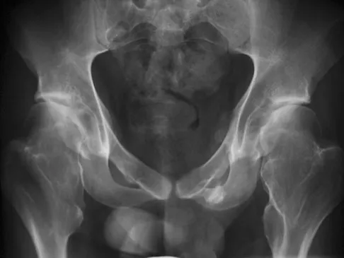 General Orthopedics 2026 Practice Questions: Set 11 (Solved) - Figure 17