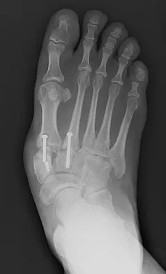 General Orthopedics 2026 Practice Questions: Set 11 (Solved) - Figure 25