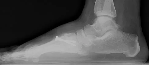 General Orthopedics 2026 Practice Questions: Set 11 (Solved) - Figure 26