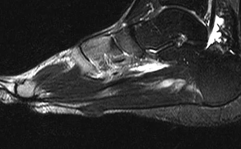 General Orthopedics 2026 Practice Questions: Set 11 (Solved) - Figure 28