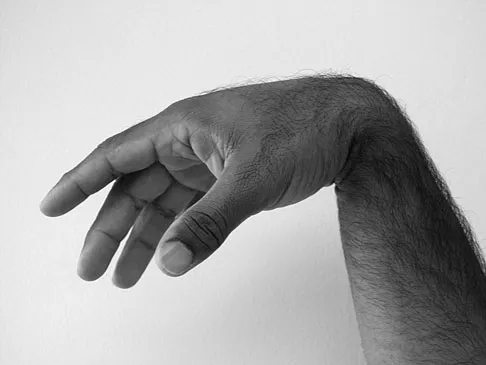 General Orthopedics 2026 Practice Questions: Set 11 (Solved) - Figure 37